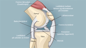 ACL-ruptur